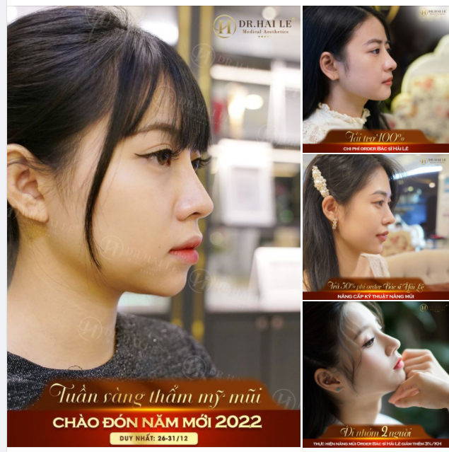 Hot girl tự nhiên mấy ai có mũi đẹp Người ta nâng mũi thì thành đẹp thôi..