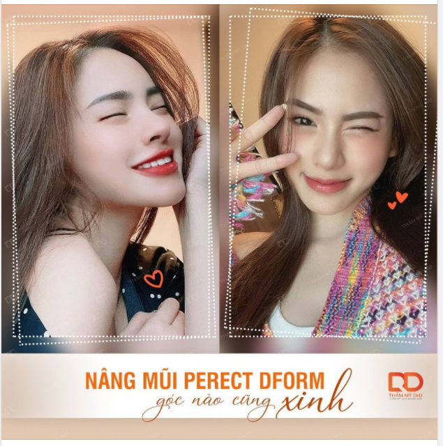 Không giống như trước, gần đây mọi người đã có xu hướng nâng mũi tự nhiên, phù hợp với tỷ lệ gương mặt của mình. Vậy nên, mũi lên dáng thì góc nào cũng xinh.