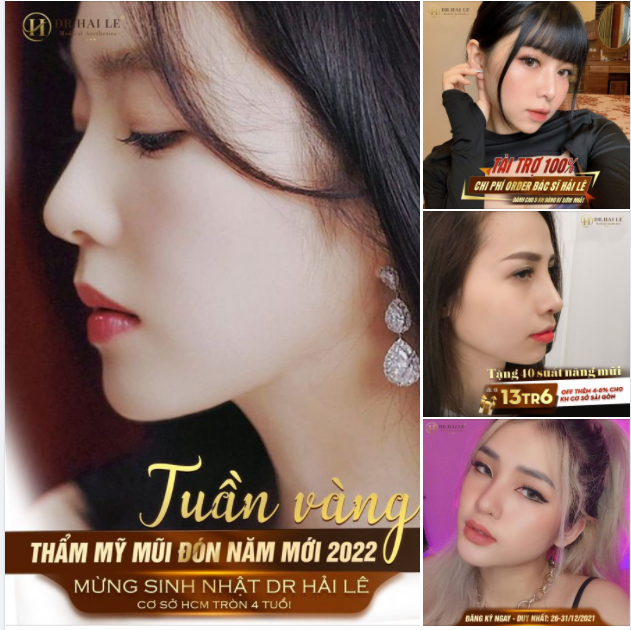 Làm đẹp thả ga - ngại chi về giá MŨI CỰC "CHẤT" - SALE CỰC HOT