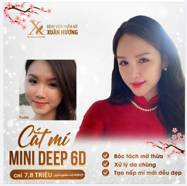 MÍ XINH ĐÓN TẾT - CAM KẾT GẤP 3 LỢI ÍCH CHỈ VỚI 7,8 TRIỆU (giá gốc 12 triệu)
