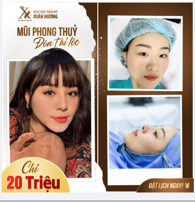 NÂNG MŨI ĐỔI VẬN, ĐÓN TÀI LỘC VẬN MAY