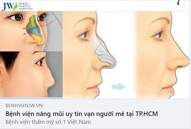 NÂNG MŨI TẠI BỆNH VIỆN JW – MŨI ĐẸP VẠN NGƯỜI MÊ