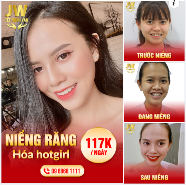 NIỀNG RĂNG 4.0 KIẾN TẠO NỤ CƯỜI ĐÓN TẾT VUI TƯƠI