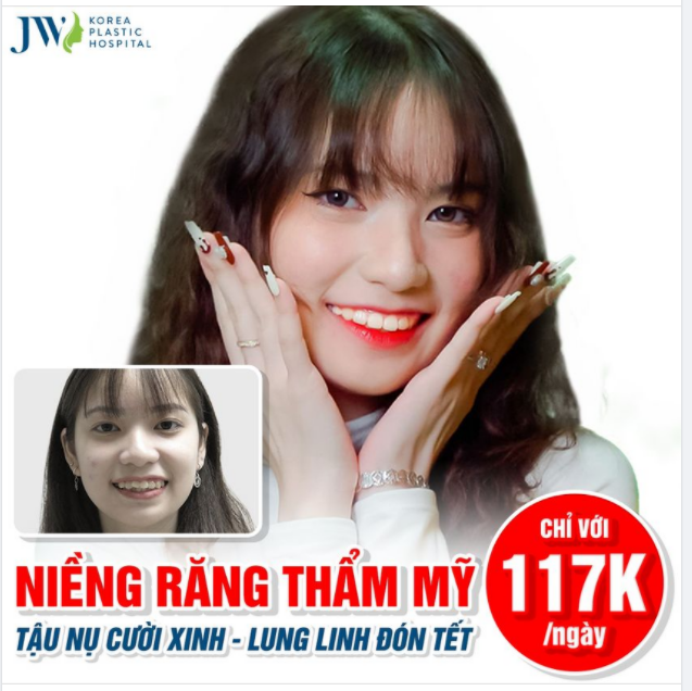 NIỀNG RĂNG THẨM MỸ - TẬU NỤ CƯỜI XINH, LUNG LINH ĐÓN TẾT
