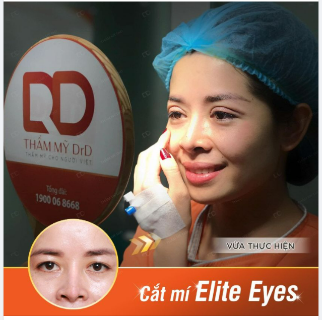 Nụ cười hạnh phúc sau khi có được một đôi mắt đẹp.