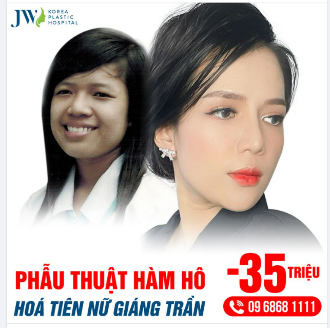 PHẪU THUẬT HÀM HÔ HOÁ TIÊN NỮ GIÁNG TRẦN