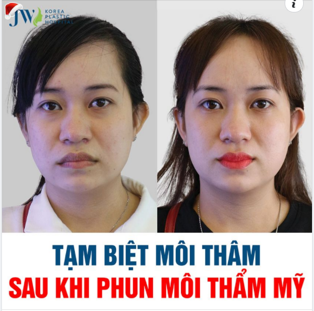 PHUN MÔI THẨM MỸ NÂNG HẠNG NHAN SẮC NÀNG ĐẸP QUYẾN RŨ