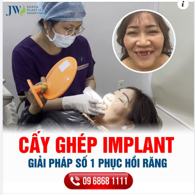 QUÝ BÀ HÀO HỨNG PHỤC HỒI RĂNG VỚI CẤY GHÉP IMPLANT