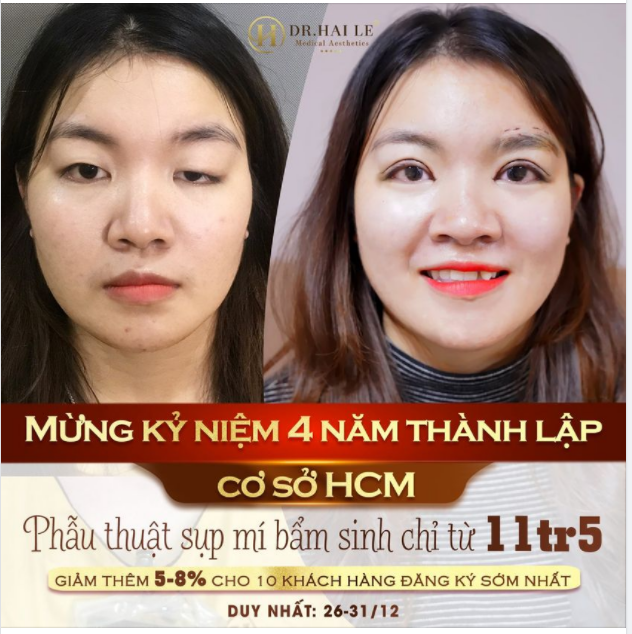 ​​​​​​​SALE SỐC TUẦN VÀNG THẨM MỸ ĐÓN NĂM MỚI 2022 - MỪNG SINH NHẬT DR HẢI LÊ CƠ SỞ HCM TRÒN 4 TUỔI