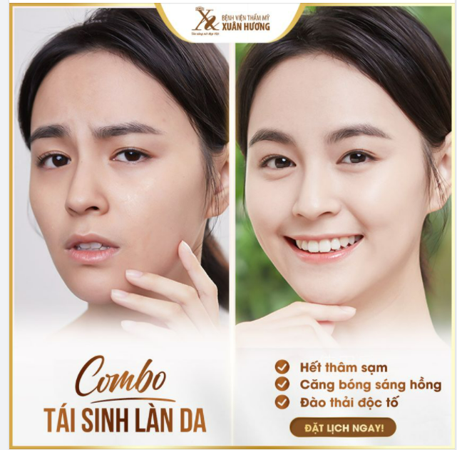TÁI SINH LÀN DA TOÀN DIỆN VỚI PHƯƠNG PHÁP 3 TÁC ĐỘNG TẠI XUÂN HƯƠNG
