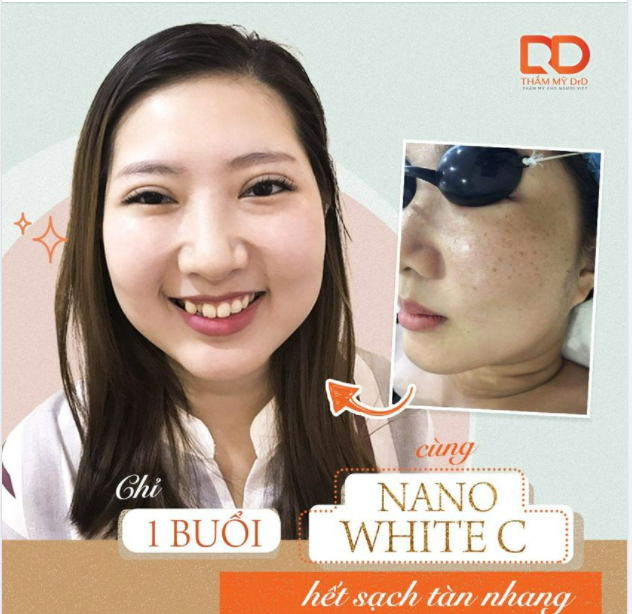 Tàn nhang để lâu không điều trị có bị lan ra không?