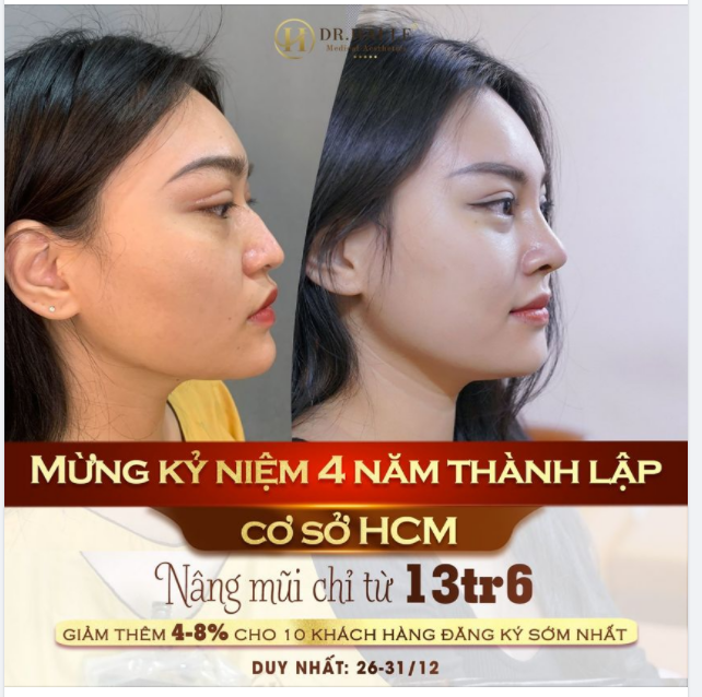 Tết này bạn đã có mũi xinh....Tus dành riêng cho khách hàng cơ sở Sài Gòn. ĐỪNG BỎ LỠ!