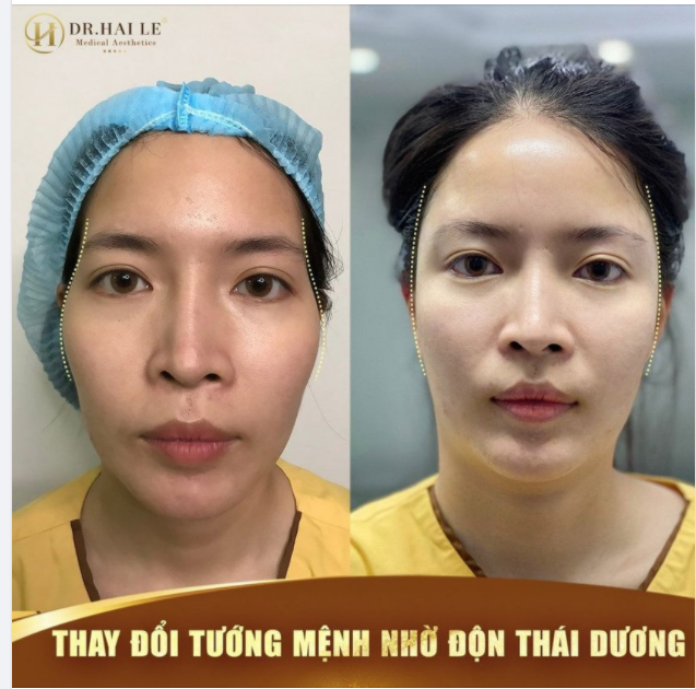 THAY ĐỔI TƯỚNG MỆNH NHỜ ĐỘN THÁI DƯƠNG!
