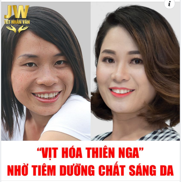 TIÊM TRẮNG SÁNG DA, CÔ GÁI ĐƯỢC KHEN ĐẸP NHƯ TIÊN NỮ