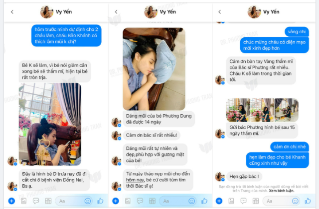 TỪ NGÀY THÁO NẸP, BÉ CỨ TỦM TỈM CƯỜI BÁC SĨ Ạ!