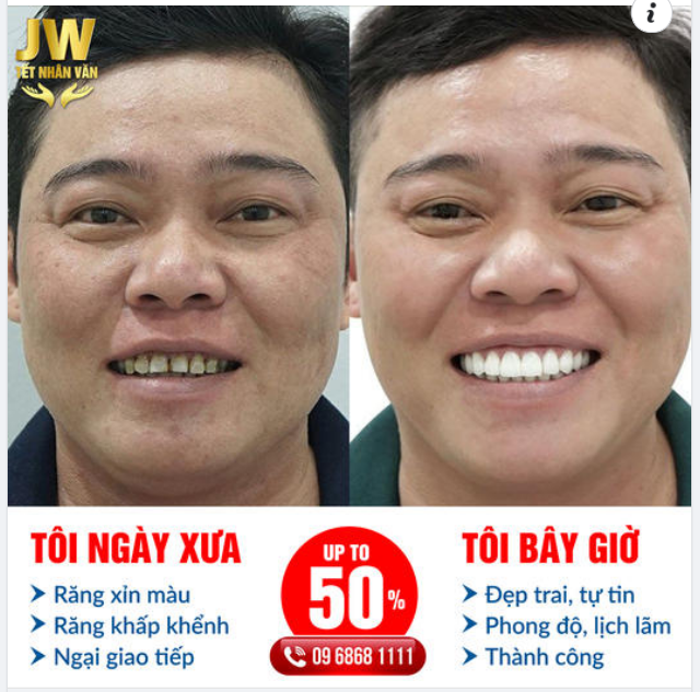TÚT LẠI NỤ CƯỜI, LẤY NGAY PHONG ĐỘ CHO CÁNH MÀY RÂU