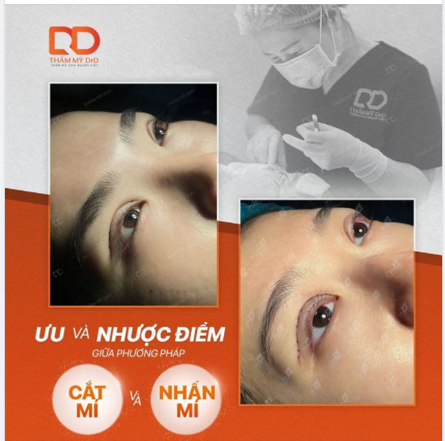ƯU VÀ NHƯỢC ĐIỂM CỦA PHƯƠNG PHÁP CẮT MÍ VÀ NHẤN MÍ