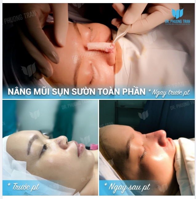 VẺ BỀ NGOÀI QUAN TRỌNG ĐẾN THẾ SAO