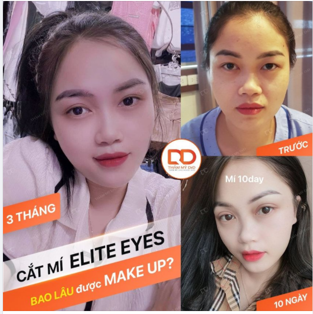 CẮT MÍ ELITE EYES SAU BAO LÂU THÌ ĐƯỢC MAKE UP