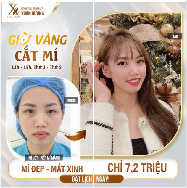 CẮT MÍ GIỜ VÀNG - NHẬN NGÀN LỢI ÍCH