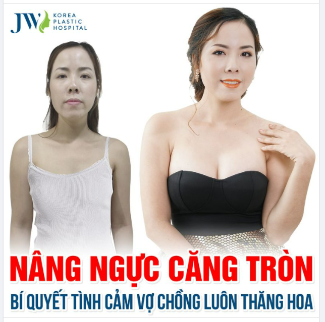 CHỊ NÀO CHỒNG BỎ CHỒNG CHÊ, ĐẾN JW NÂNG NGỰC CHỒNG MÊ TỚI GIÀ