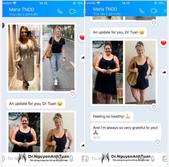 Chúng tôi cam kết giúp bạn đạt được mục tiêu của mình về một cuộc sống lành mạnh, hạnh phúc hơn thông qua phẫu thuật nội soi Thu nhỏ Dạ dày giảm béo