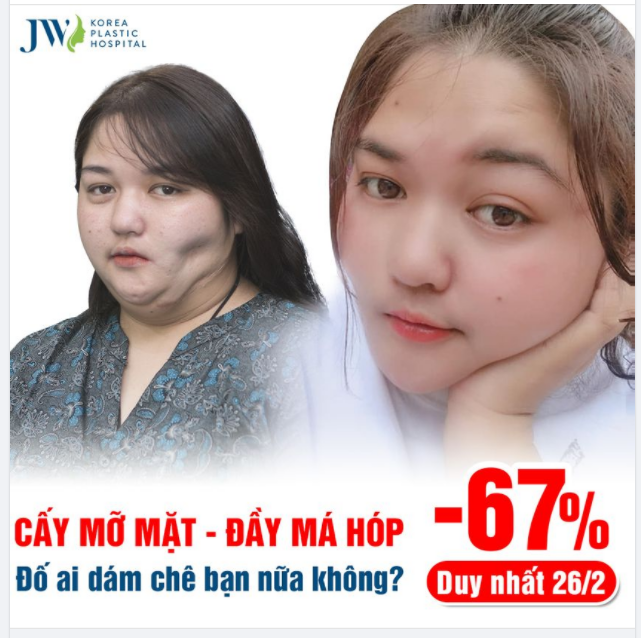 CÔ GÁI MẶT LÕM ĐÃ LẤP ĐẦY MÁ HÓP KHẮC KHỔ NHƯ THẾ NÀO