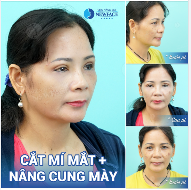 COMBO MẮT - TRẺ ĐẸP TỨC THÌ