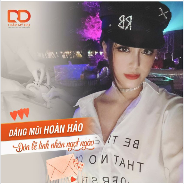 Combo Nâng mũi Sline Dform + Cắt mí Elite Eyes.