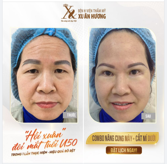 COMBO THẦN THÁNH GIÚP TRẺ HÓA KHUÔN MẮT HIỆU QUẢ