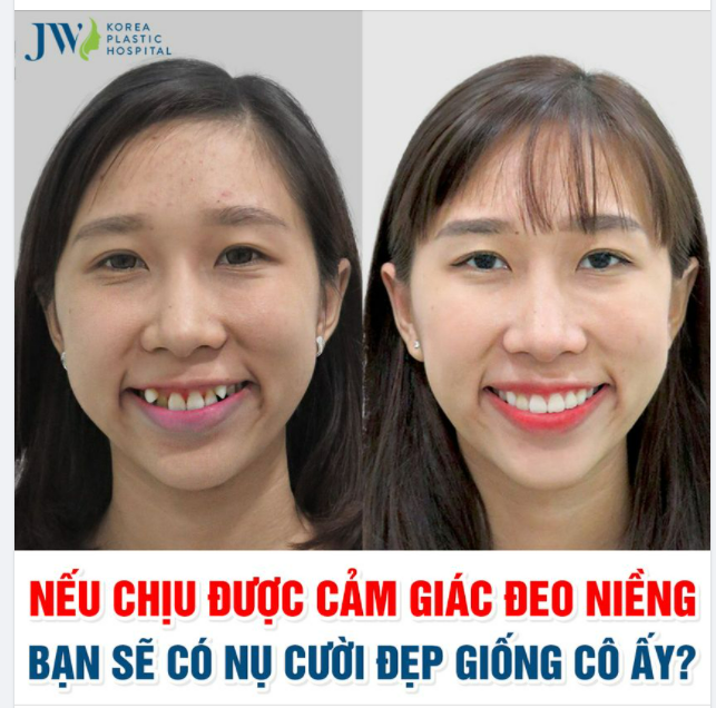 ĐỐ BẠN CÔ GÁI ẤY ĐÃ LÀM GÌ ĐỂ CÓ NỤ CƯỜI ĐẸP NHƯ THẾ