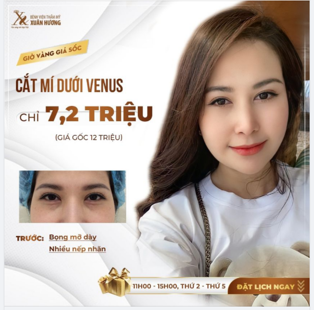 ĐỪNG ĐỂ BỌNG MỠ MÍ DƯỚI TRỞ THÀNH GÁNH NẶNG KHIẾN ĐÔI MẮT THÊM MỆT MỎI!