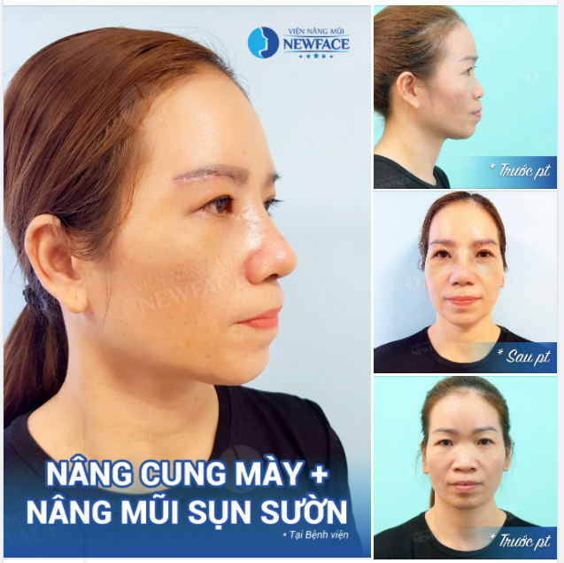 Hôm nay trời nắng đẹp Đem nỗi buồn ra phơi Nỗi buồn bốc hơi hết Hóa thành mây trên trời