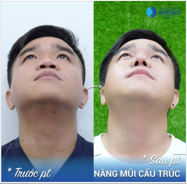 MỘT SỰ THAY ĐỔI QUÁ TÍCH CỰC PHẢI KHÔNG