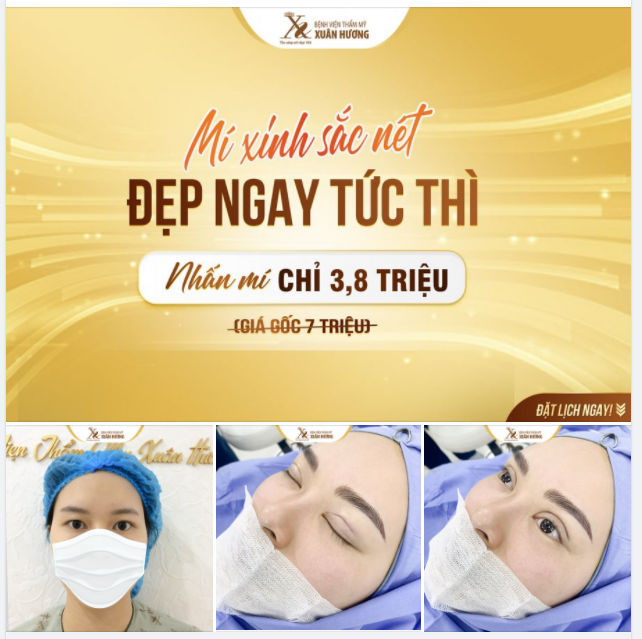 NẾP MÍ SẮC NÉT THỂ HIỆN TAY NGHỀ CHUẨN CHỈ CỦA BÁC SĨ TẠI BVTM XUÂN HƯƠNG