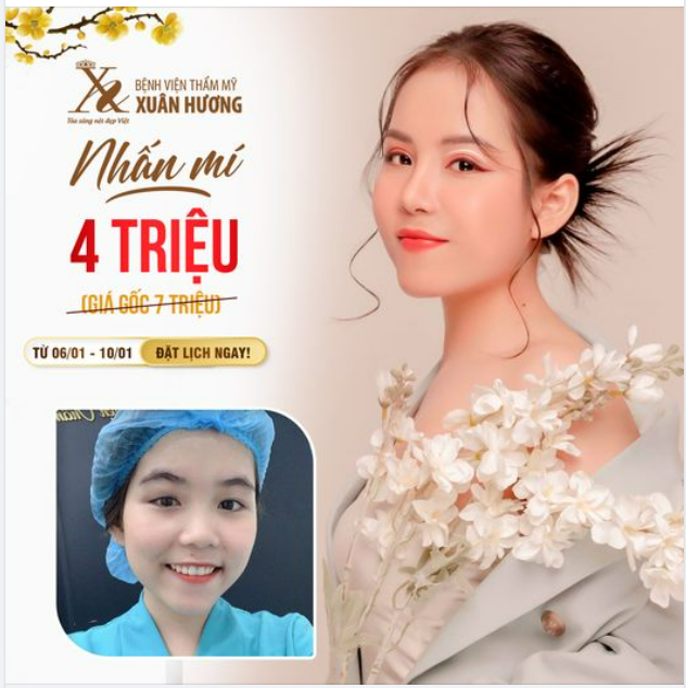 NHẤN MÍ KHAI XUÂN CHỈ 4 TRIỆU (GIÁ GỐC 7 TRIỆU)
