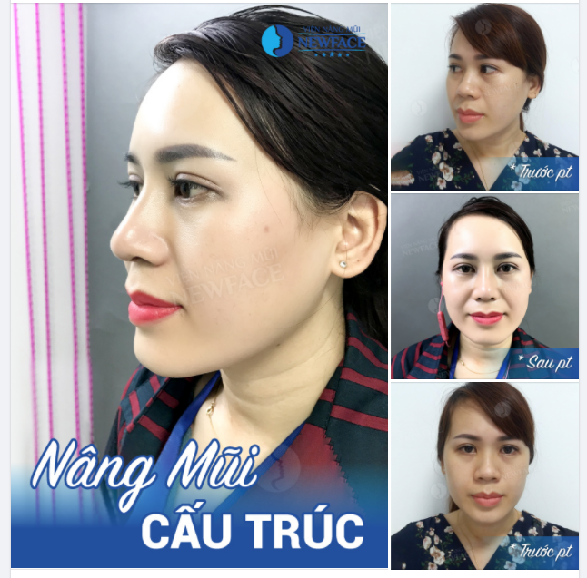 ƠN GIỜI, GÓC NGHIÊNG “THẦN THÁNH” QUÁ!