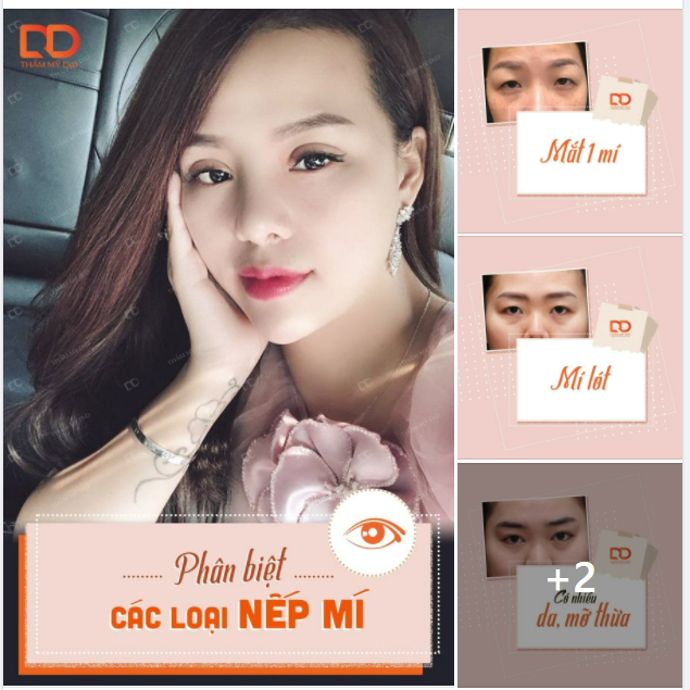 PHÂN BIỆT CÁC LOẠI NẾP MÍ VÀ CÁCH KHẮC PHỤC