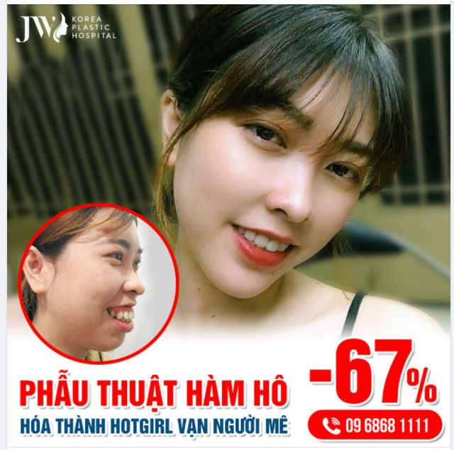 PHẪU THUẬT HÀM HÔ - HÓA THÀNH HOT GIRL VẠN NGƯỜI MÊ
