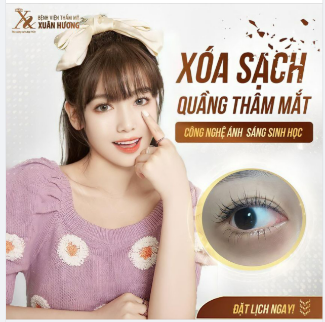 PHƯƠNG PHÁP TRỊ THÂM MẮT HIỆU QUẢ NHẤT