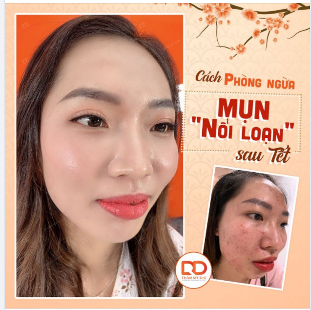 Tết mà, kiểu gì cũng phải ăn cho thỏa thích các đồ chiên rán, uống cho đã cái nư các loại đồ ngọt và đồ có cồn.