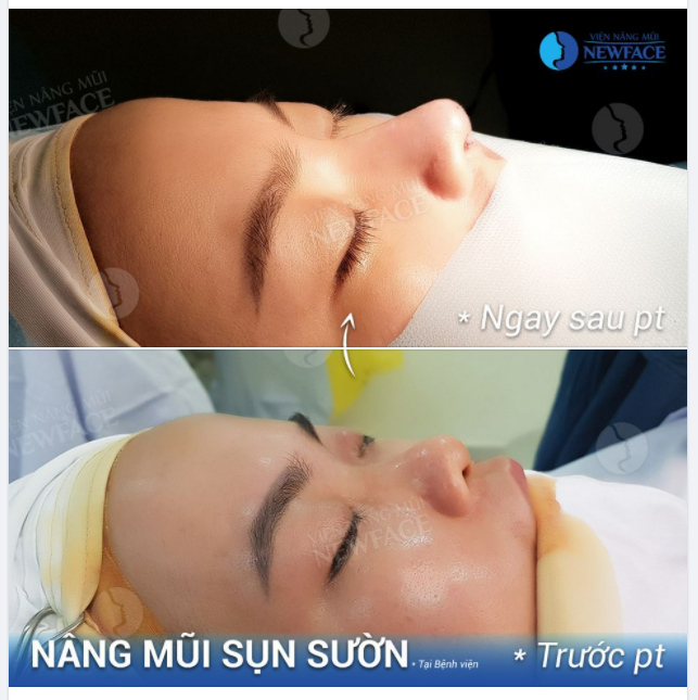 TUYỆT VỜI NGOÀI SỨC TƯỞNG TƯỢNG