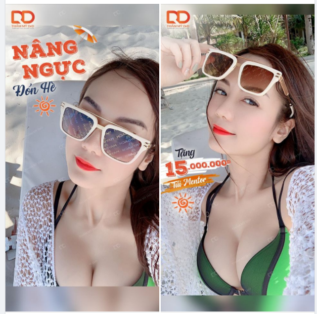 2 bước đơn giản để sở hữu vòng 1 tiêu điểm cho mùa hè sắp tới.
