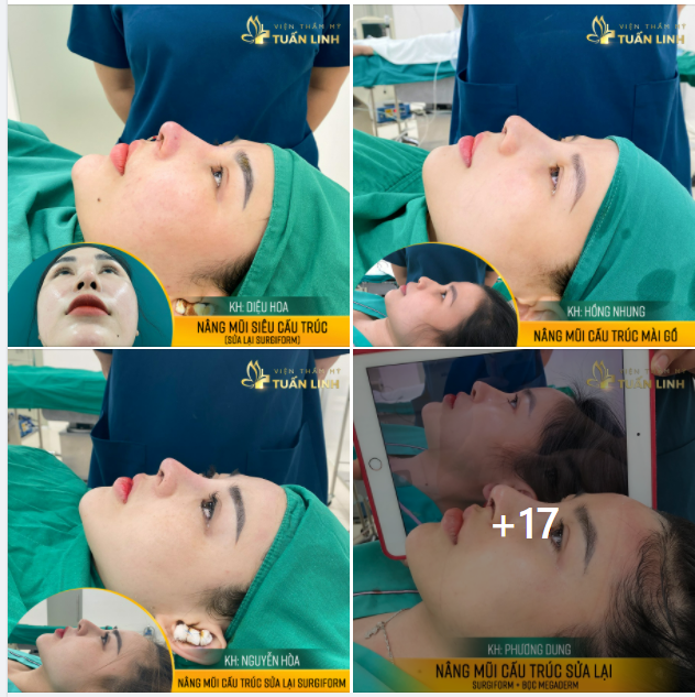 20 CA PHẪU THUẬT TRONG NGÀY - MỆT NHƯNG VUI Ạ!!!