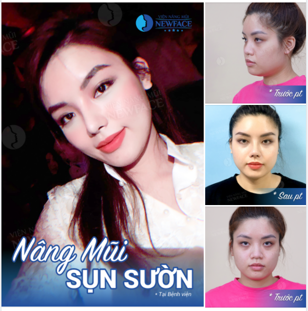 Anh sẽ không bao giờ thấy trời tối Vì gặp được em là sáng suốt!