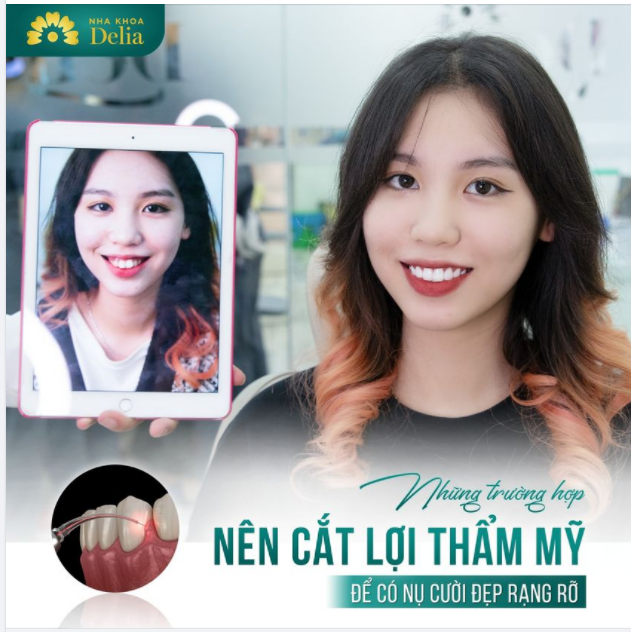 Bác sĩ từ Delia trả lời KHÔNG PHẢI AI CŨNG CẦN CẮT LỢI THẨM MỸ