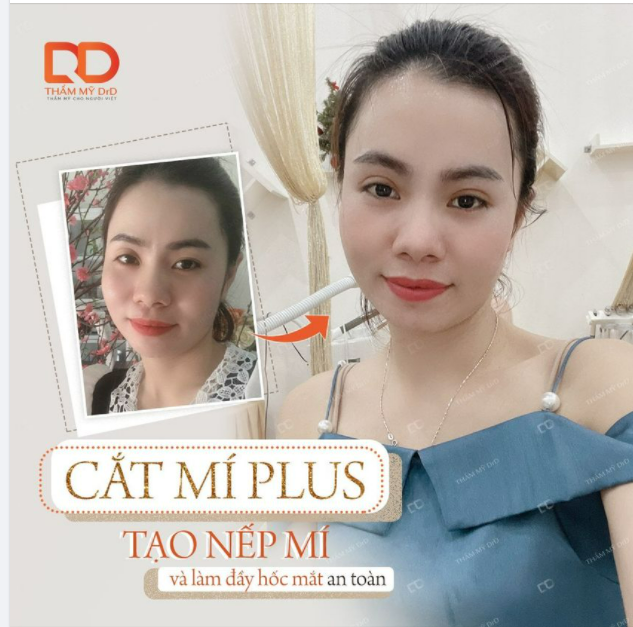 Bạn có lỡ bỏ qua khuyết điểm đôi mắt của mình