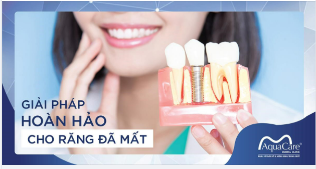 Bạn đang tìm giải pháp thay thế mất răng 