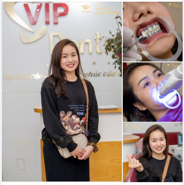 BẬT MÍ BÍ QUYẾT TRẮNG RĂNG CHỈ SAU 40P