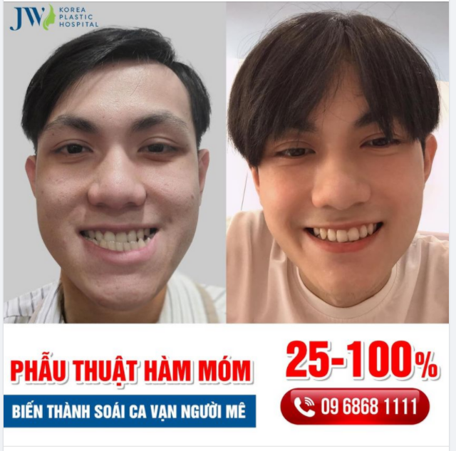 BẬT NGỬA CHÀNG TRAI PHẪU THUẬT HÀM MÓM HOÁ THÀNH SOÁI CA